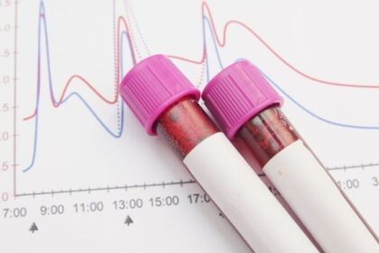 Vials of blood over a blood sugar chart